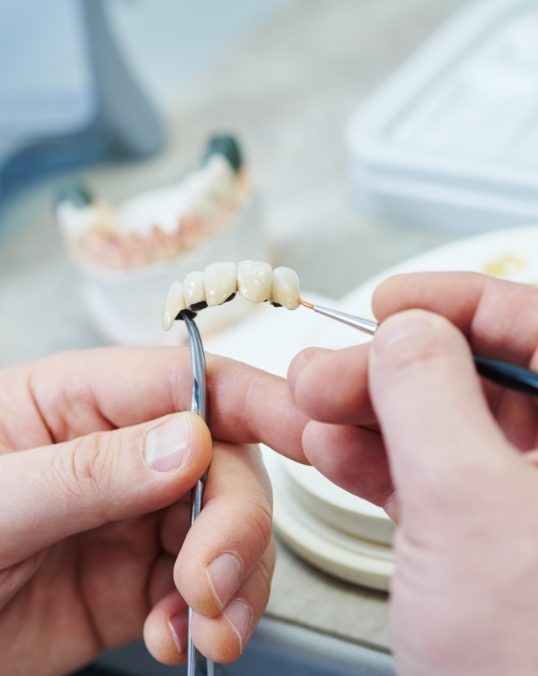Dentist crafting a dental crown and bridge