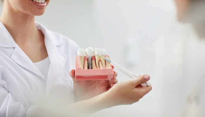 Dentist pointing to a model of a dental implant in the jaw