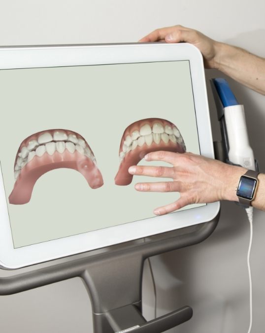 Dentist pointing to digital scans of a patient's teeth on computer monitor