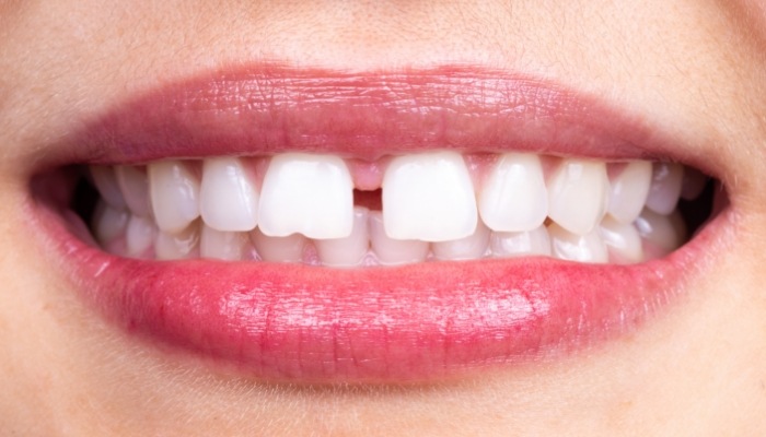 Close up of a small gap between a person's two front teeth