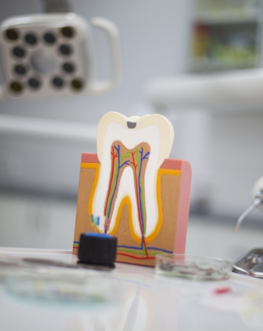 Model of a tooth showing the root canals and nerve pathways
