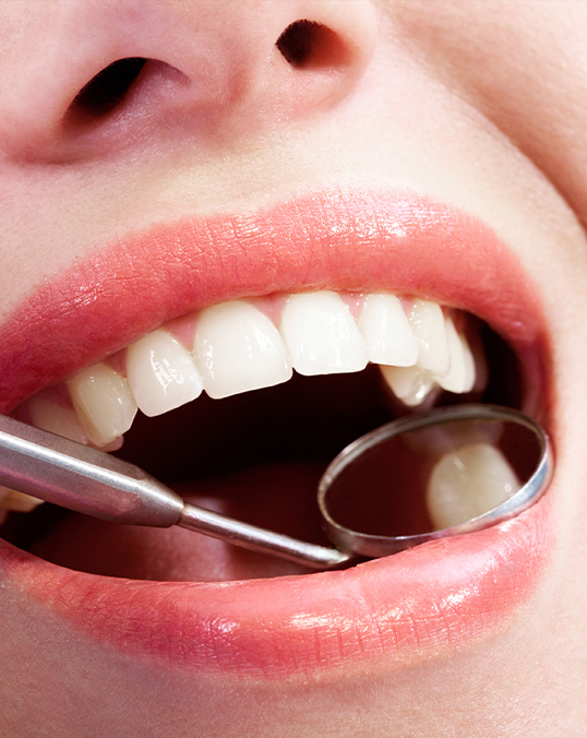 Close up of a dental mirror inside of a mouth