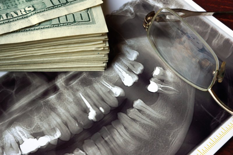 A dental X-ray next to a stack of money.